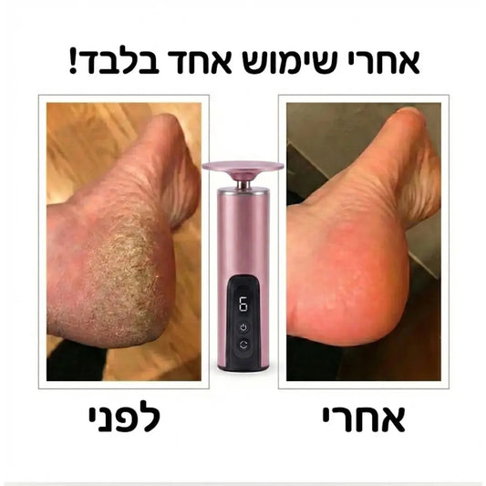 ערכת הפדיקור של TRILO